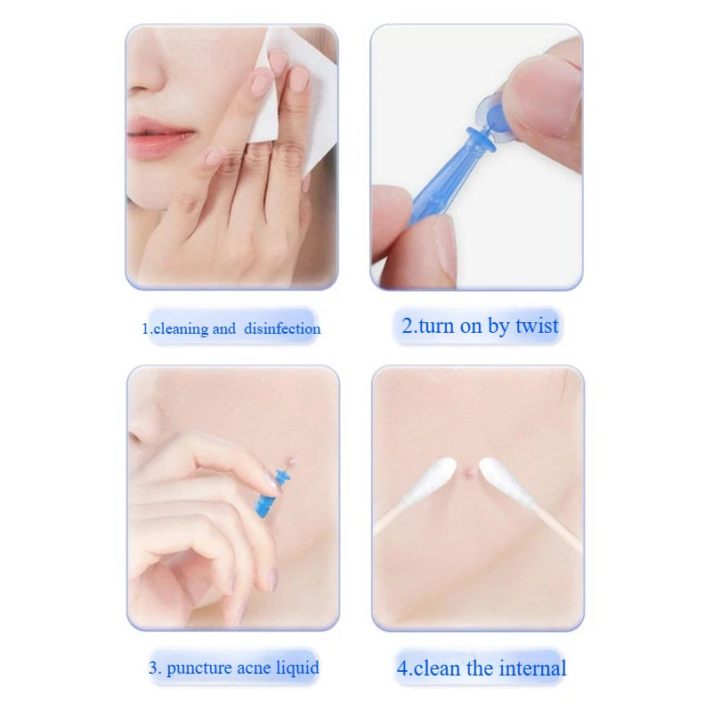 Disposable Blackhead Remover Acne Needles Stainless Steel Needles Blackhead Remover