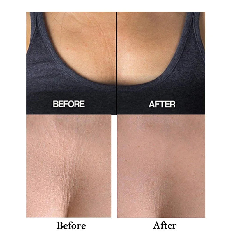 Reusable Chest Lift Patch Self-adhesive Chest Neck Pad Silicone Anti-Aging Wrinkle Remover Pad