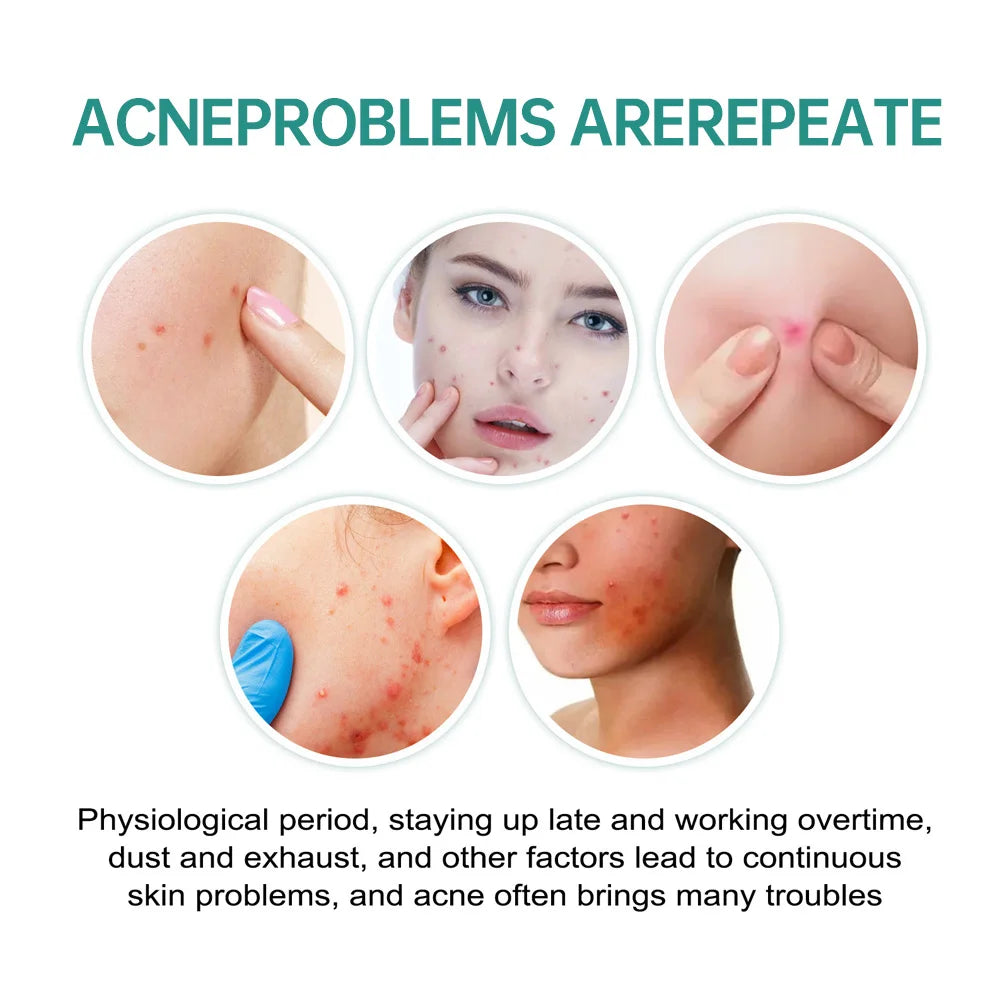 Invisible Pimple Patch Acne Patches Professional Face Skin Care Repair Cover Acne Healing Absorbing Spot Sticker