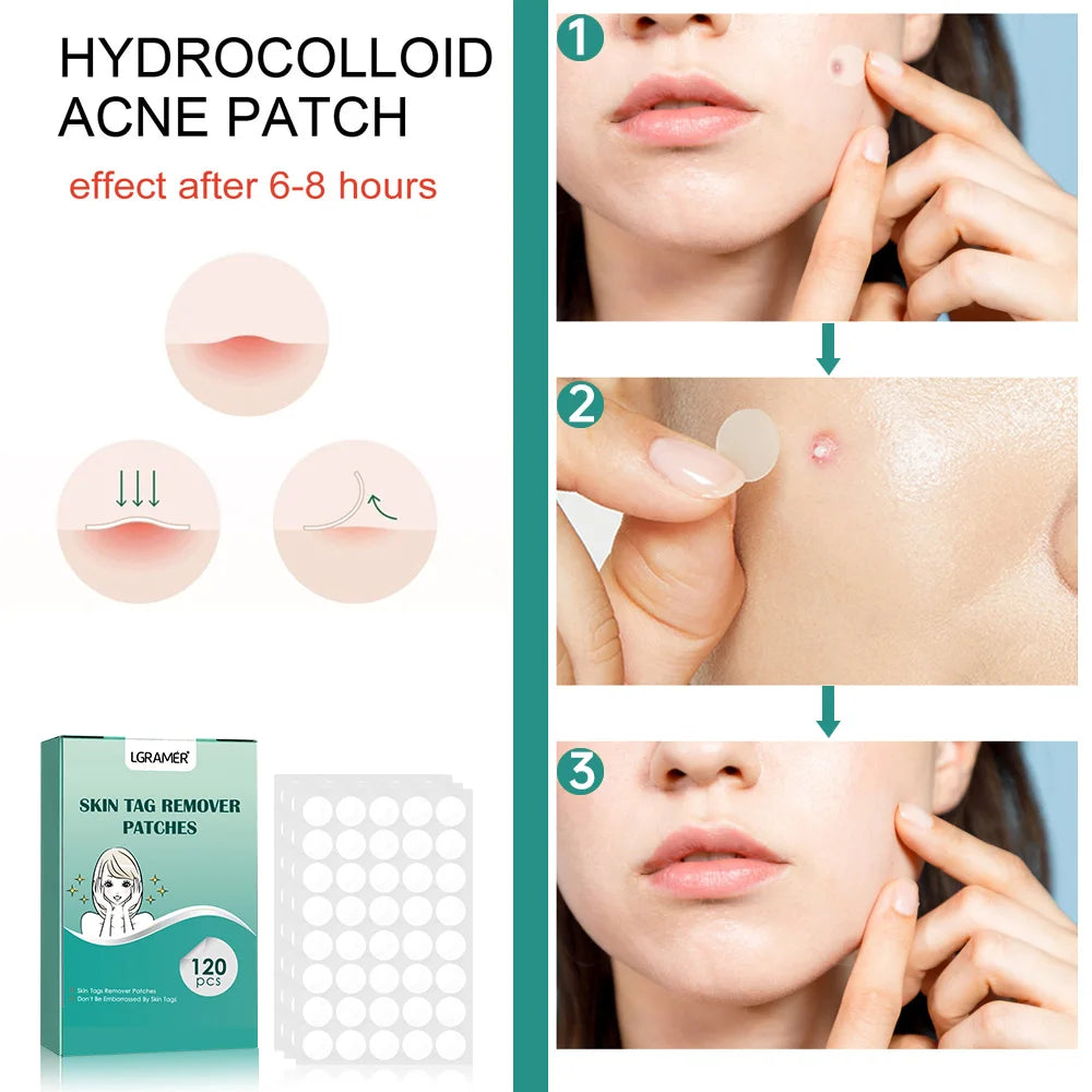 Invisible Pimple Patch Acne Patches Professional Face Skin Care Repair Cover Acne Healing Absorbing Spot Sticker