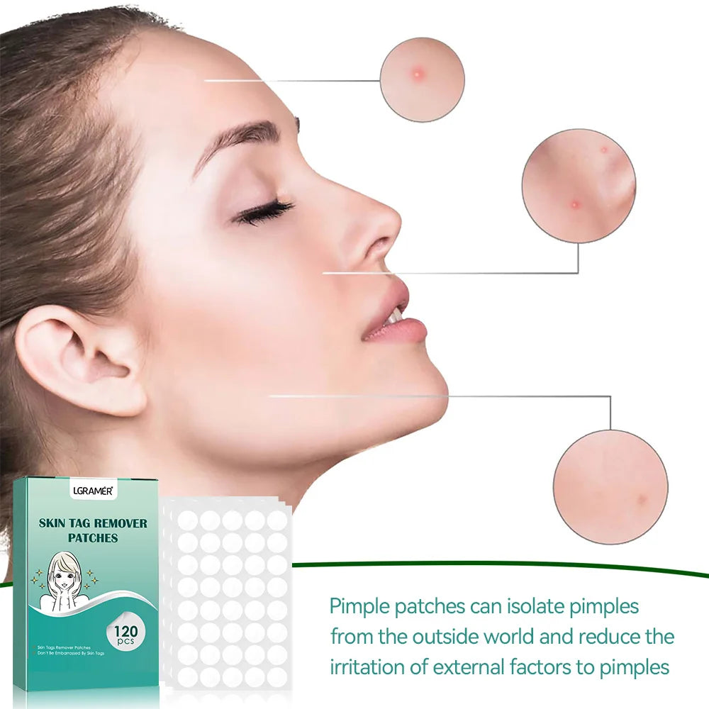 Invisible Pimple Patch Acne Patches Professional Face Skin Care Repair Cover Acne Healing Absorbing Spot Sticker